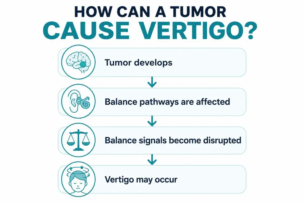 Simple flowchart infographic showing how a tumor can cause vertigo by affecting balance pathways, disrupting balance signals, and leading to dizziness or a spinning sensation.