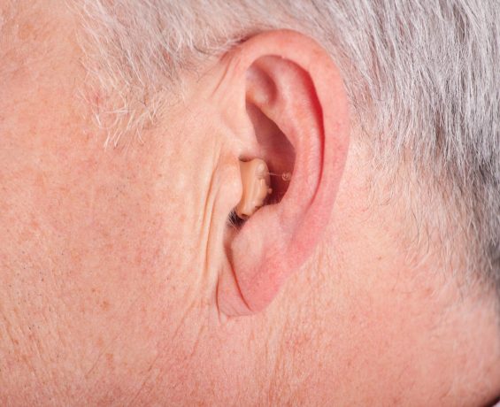 In the Ear Hearing Aids